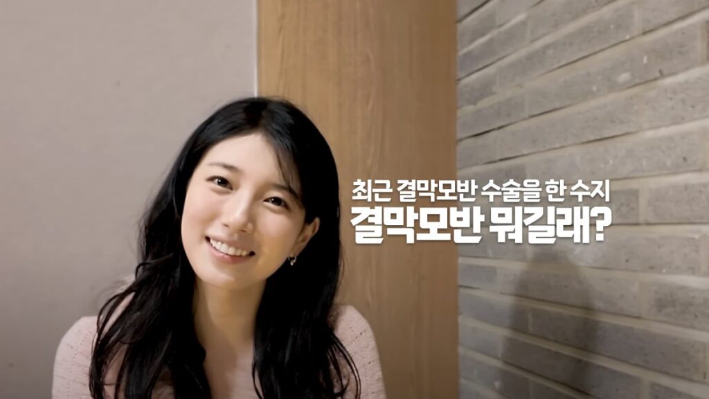 최근 결막모반 수술을 한 수지 | 결막모반 뭐길래?