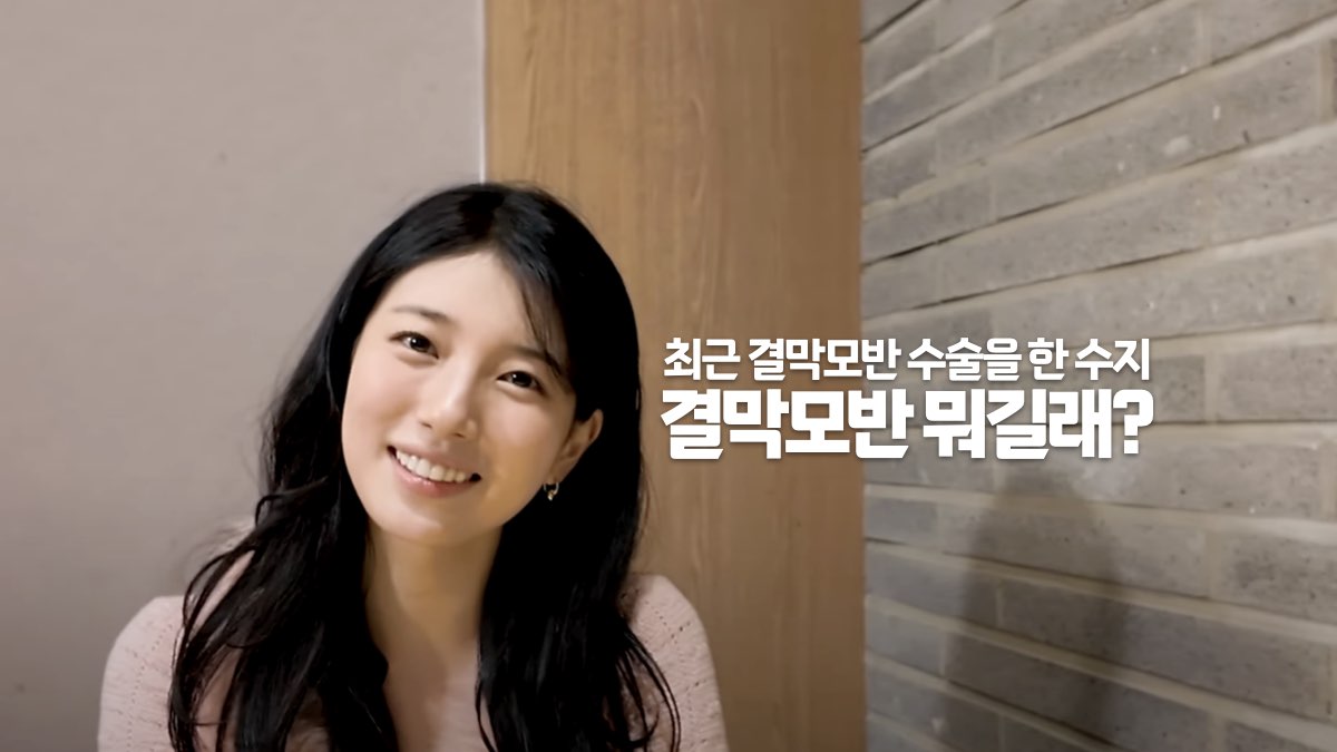 최근 결막모반 수술을 한 수지 | 결막모반 뭐길래?